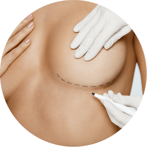 chirurgia estetica seno